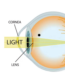 Corneal Care | Victoria Eye Center | Victoria, Texas